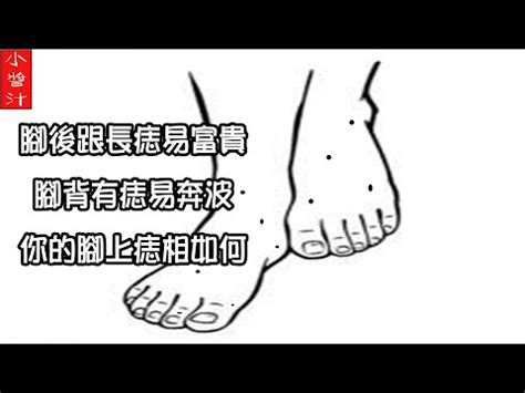 腳側有痣|非富即貴！5種腳相註定好命 痣長在這裡「天生帝王命。